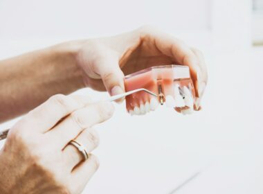 Naturalne sposoby na łagodzenie bólu po zabiegu dentystycznym